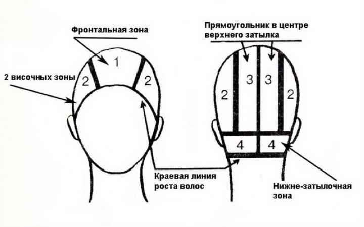 Что такое фронтально теменная зона волос